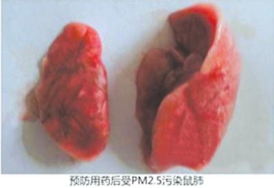網(wǎng)上文稿展示的正常鼠肺2